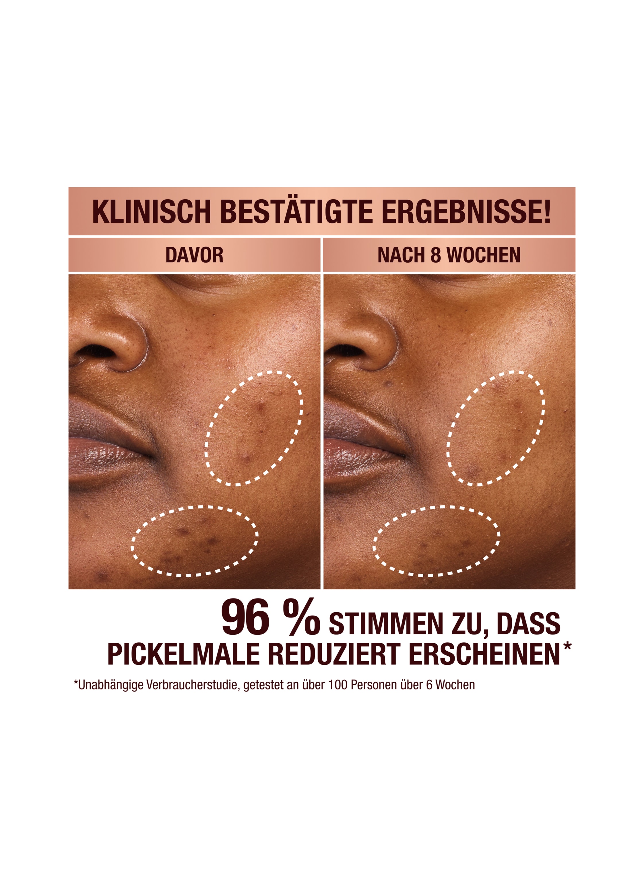 Thumbnail - Charlotte Tilbury Dark Spot Correcting Radiance Recovery Serum Serum 10 ml