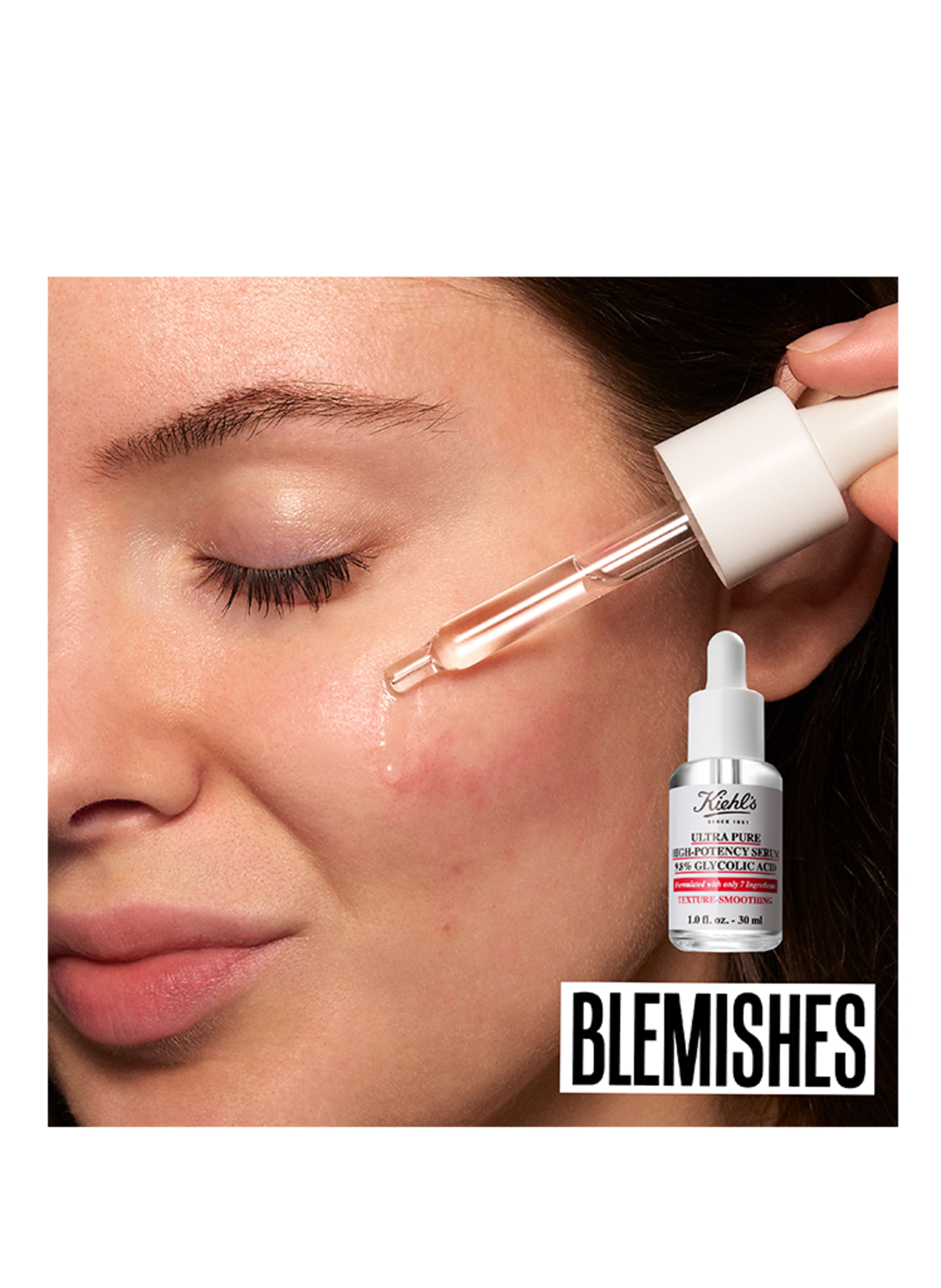 Thumbnail - Kiehl's Ultra Pure High-Potency Serum 9.8% Glycolic Acid Serum 30 ml