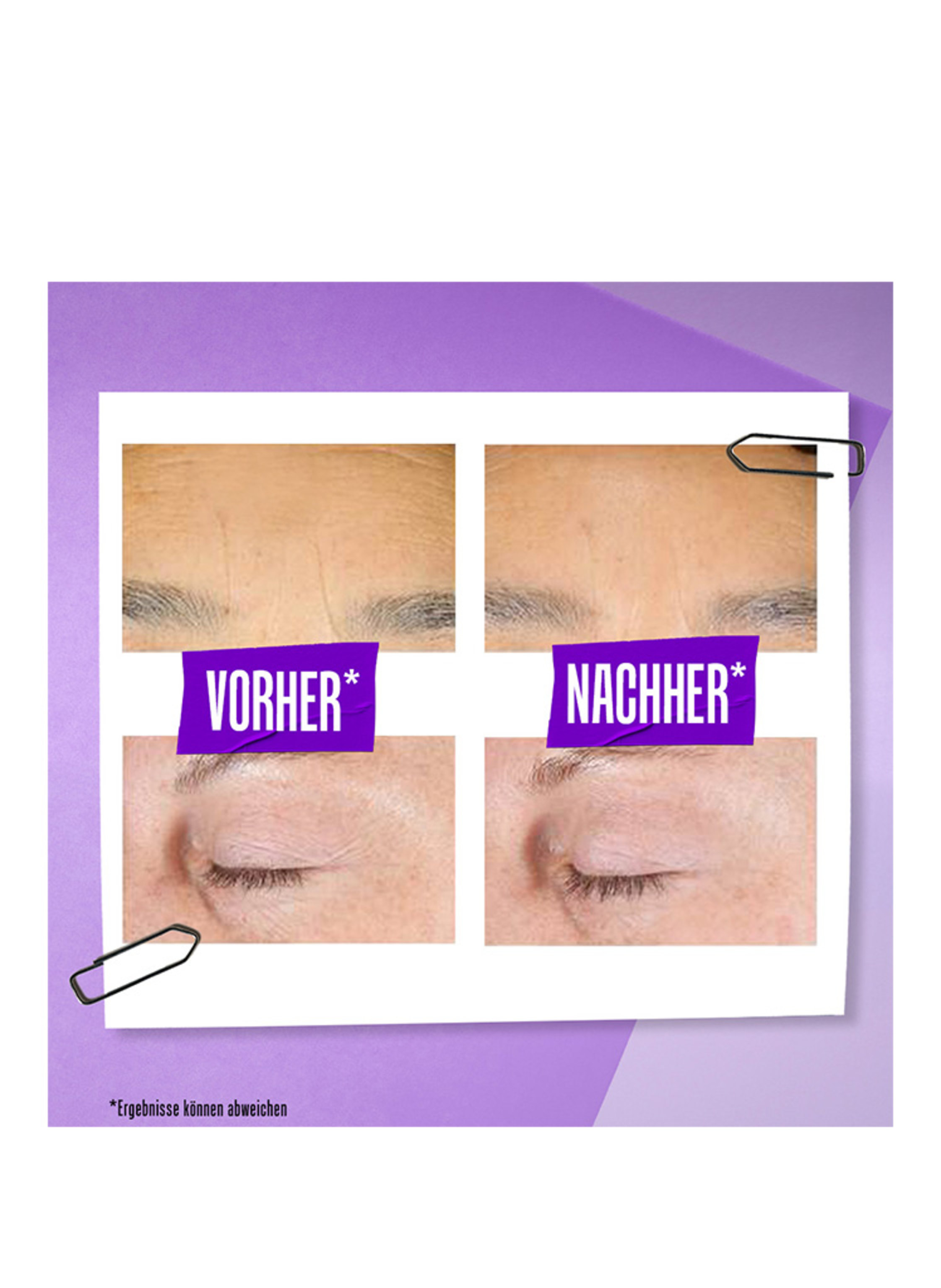 Thumbnail - Kiehl's Retinol Micro-Dose Treatment Serum 30 ml