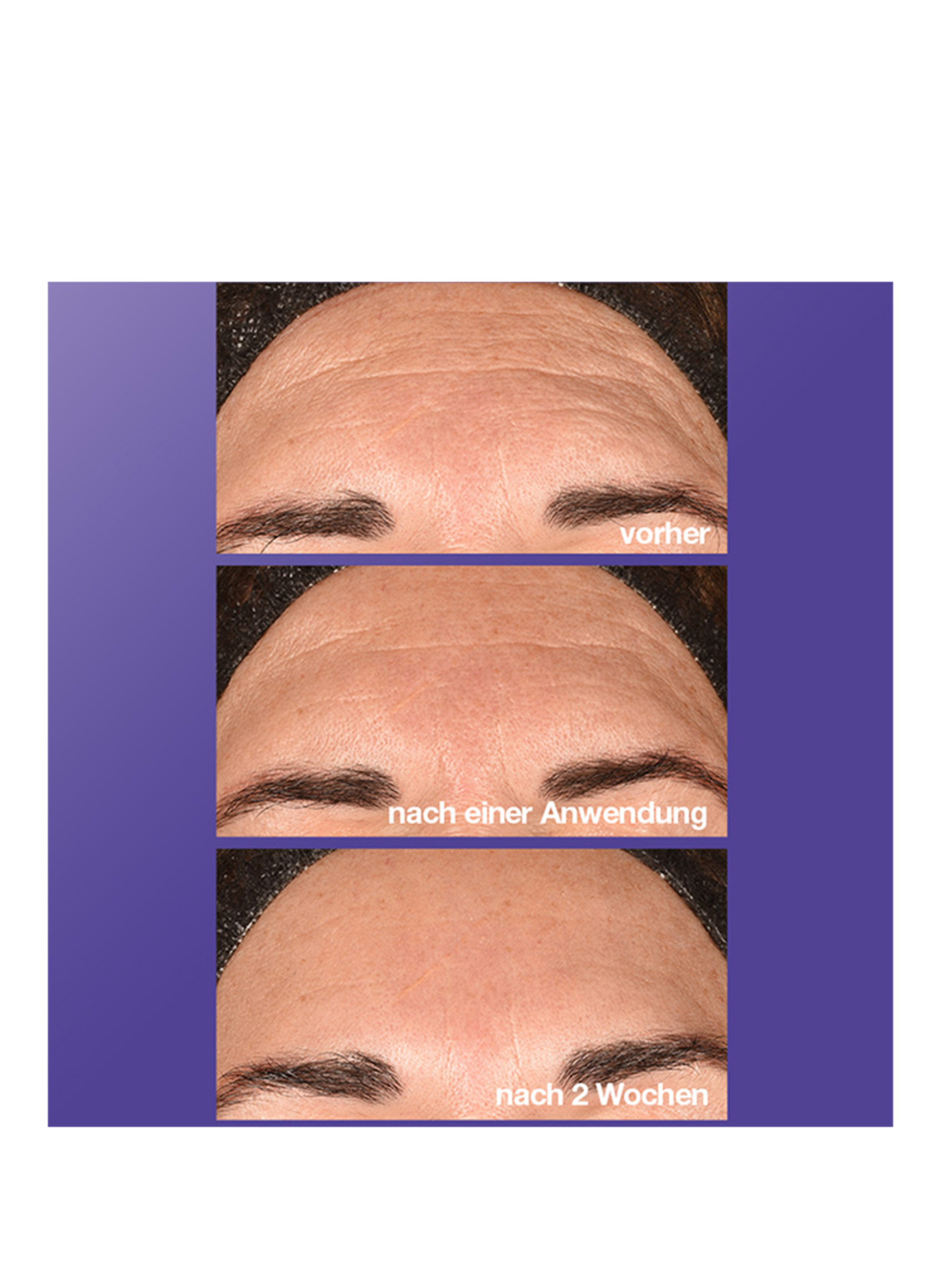 Thumbnail - Dermalogica Phyto Nature e² Regenerierendes Serum 100 ml