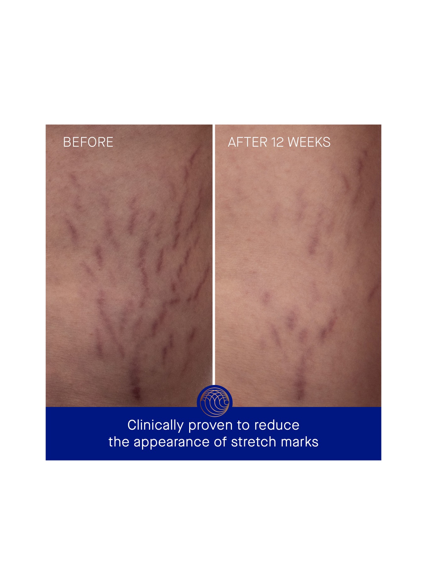 Augustinus Bader RÓŻA GERANIUM