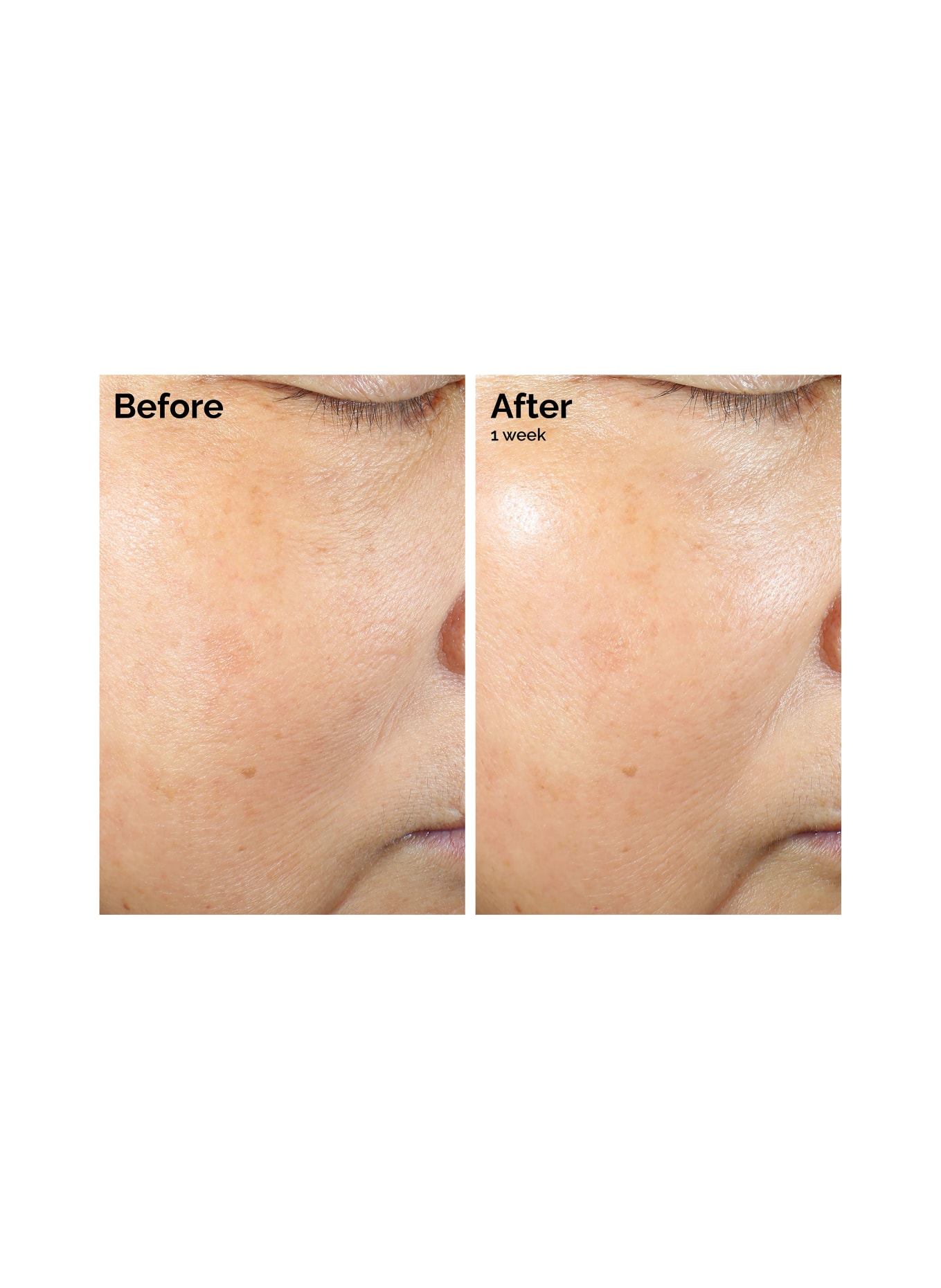 The Ordinary. RICE LIPIDS + ECTOIN MICROEMULSION