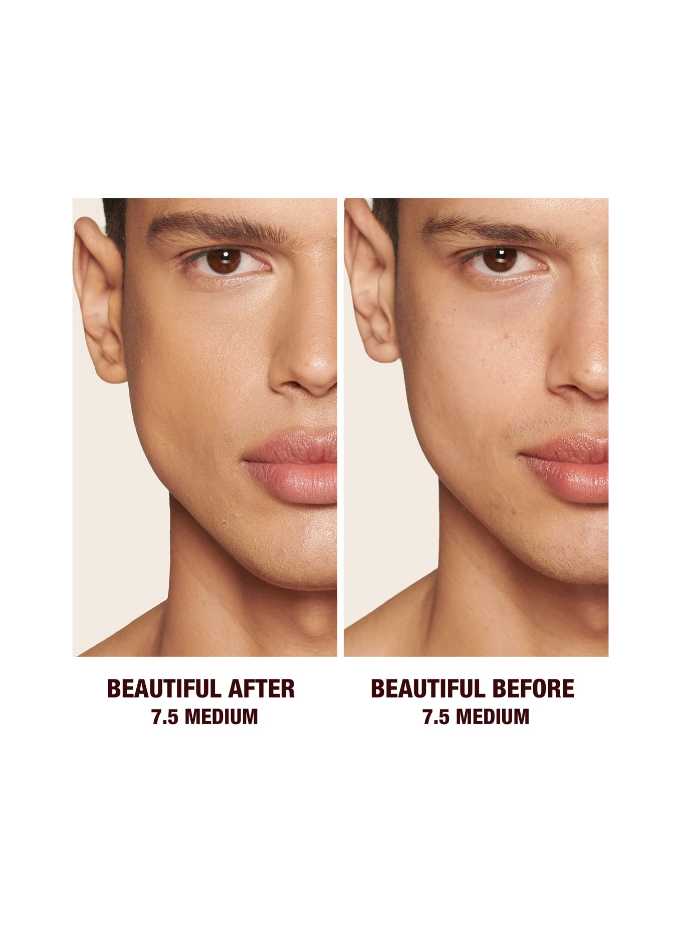 Charlotte Tilbury BEAUTIFUL SKIN RADIANT CONCEALER: 7.5 MEDIUM