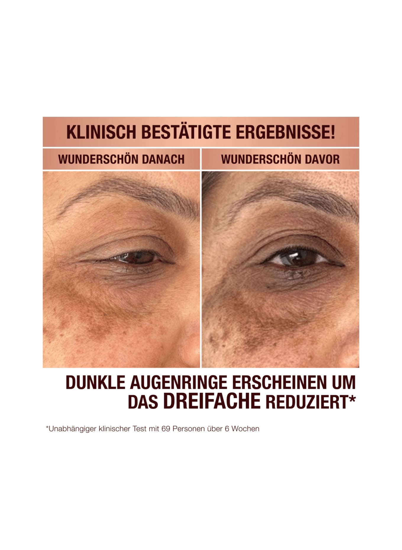 Charlotte Tilbury DARK SPOT CORRECTING RADIANCE RECOVERY SERUM