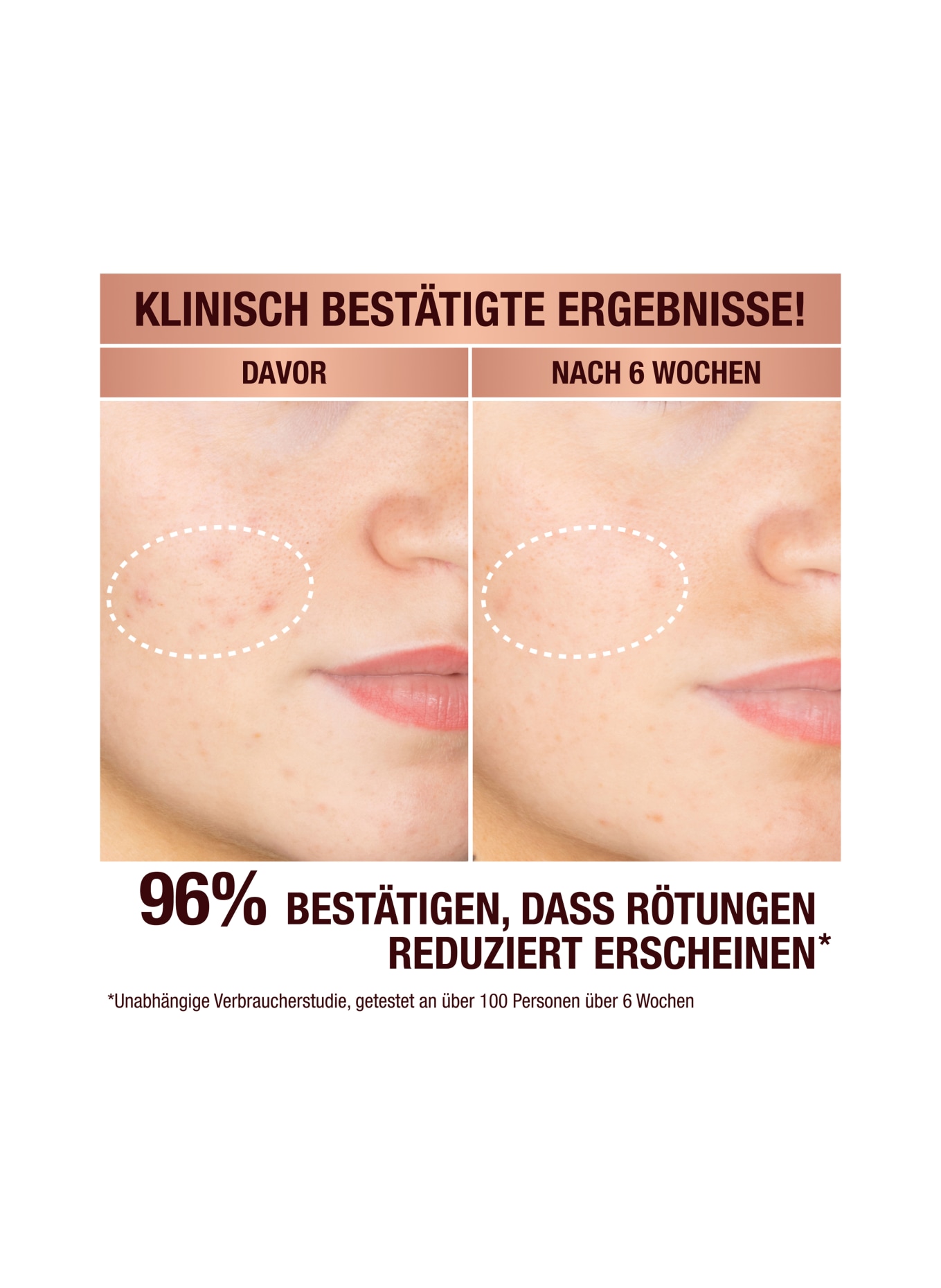 Charlotte Tilbury DARK SPOT CORRECTING RADIANCE RECOVERY SERUM