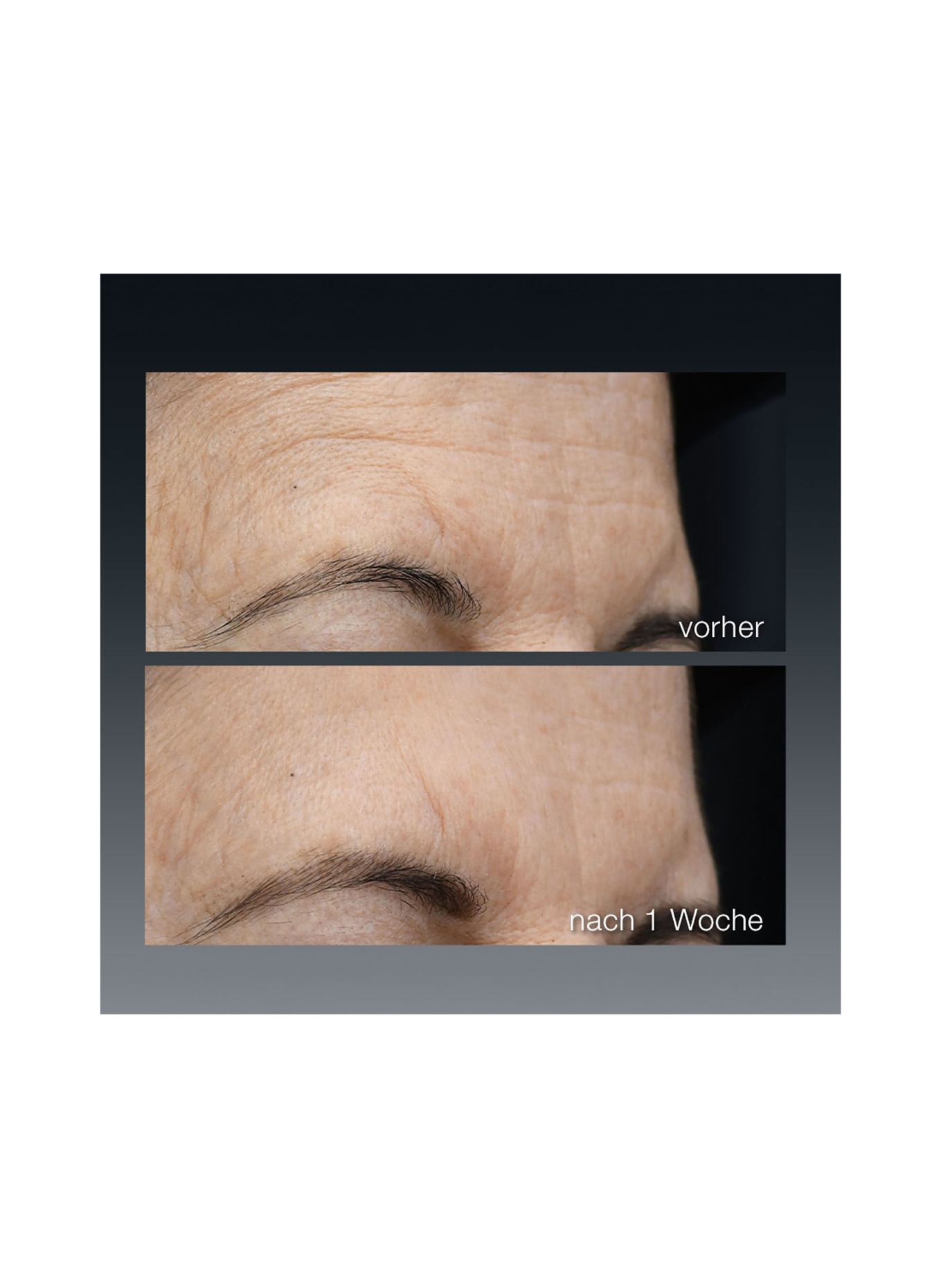 dermalogica FUTURECODE BOOSTER