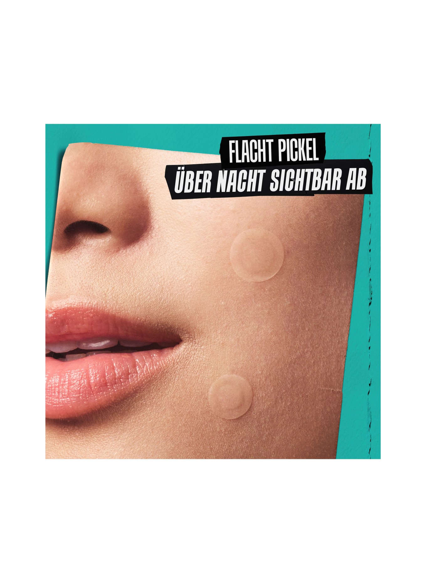 Kiehl's TRULY TARGETED OVERNIGHT ACNE PATCH