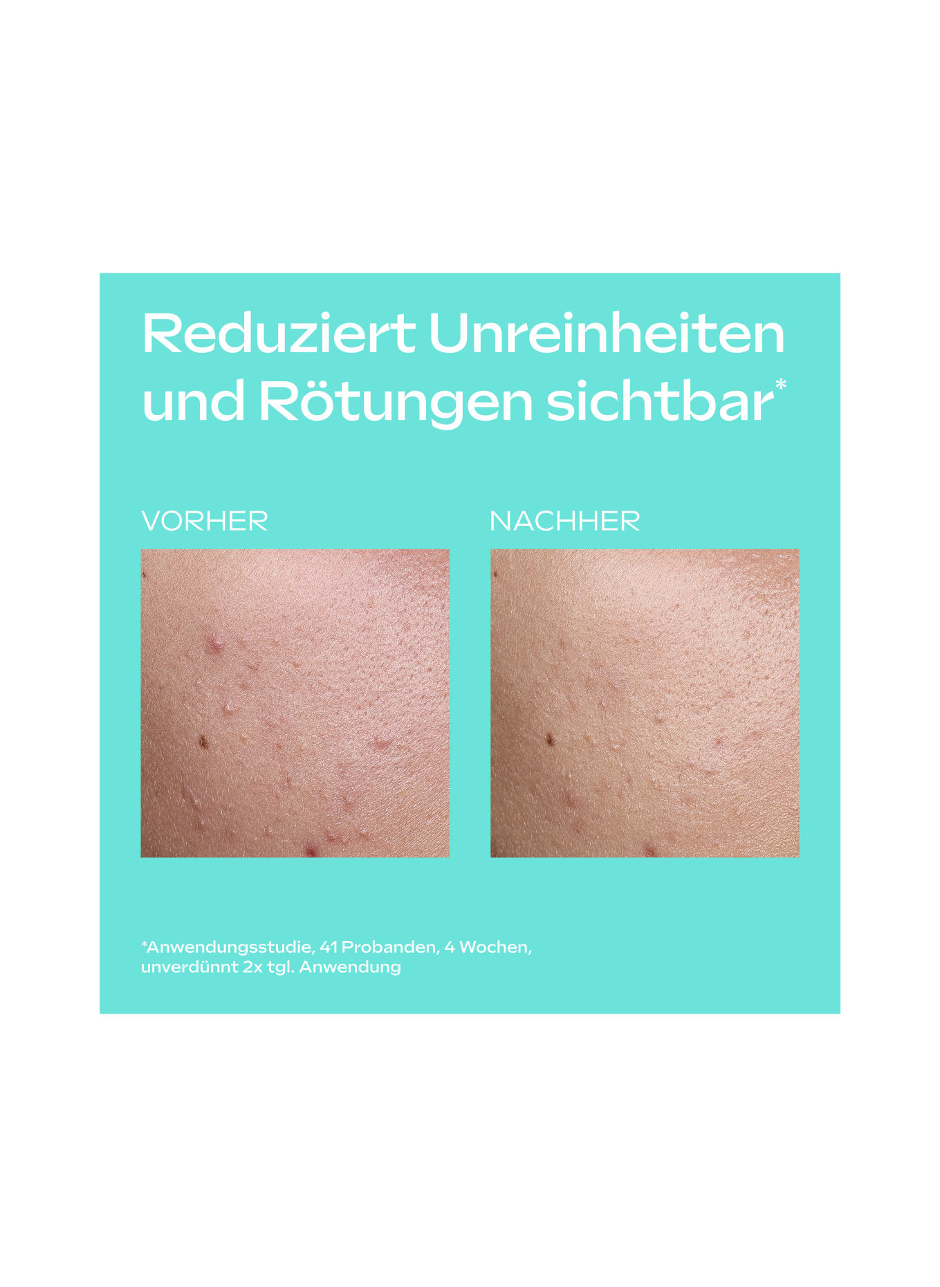 WELEDA CLEAR & PURE SKIN SERUM DROPS
