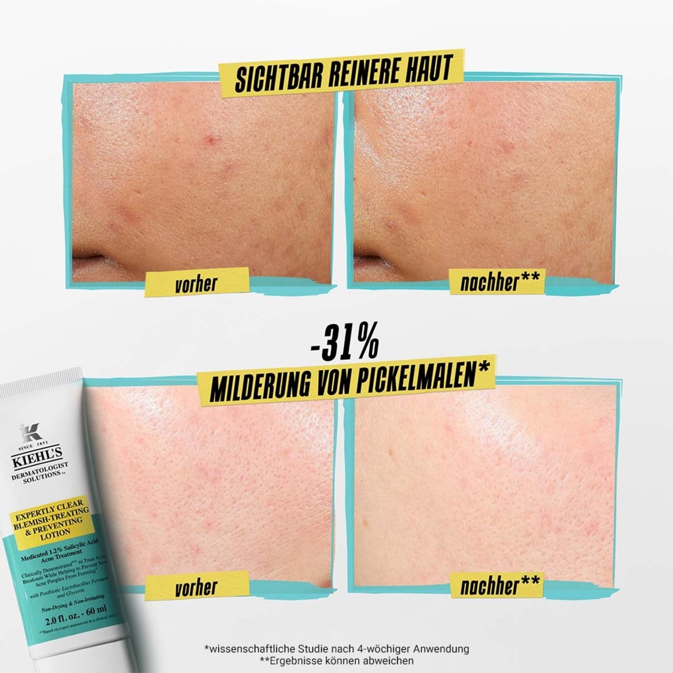 Kiehl's EXPERTLY CLEAR BLEMISH TREATING & PREVENTING LOTION (Obrazek 6)