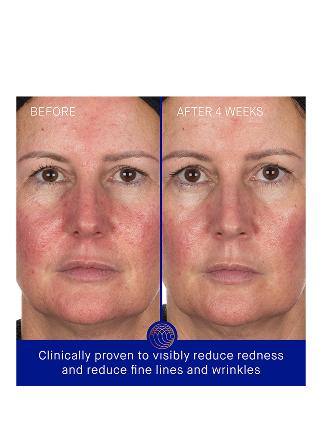 Augustinus Bader THE HYDROGEL FACE MASK 6-PACK