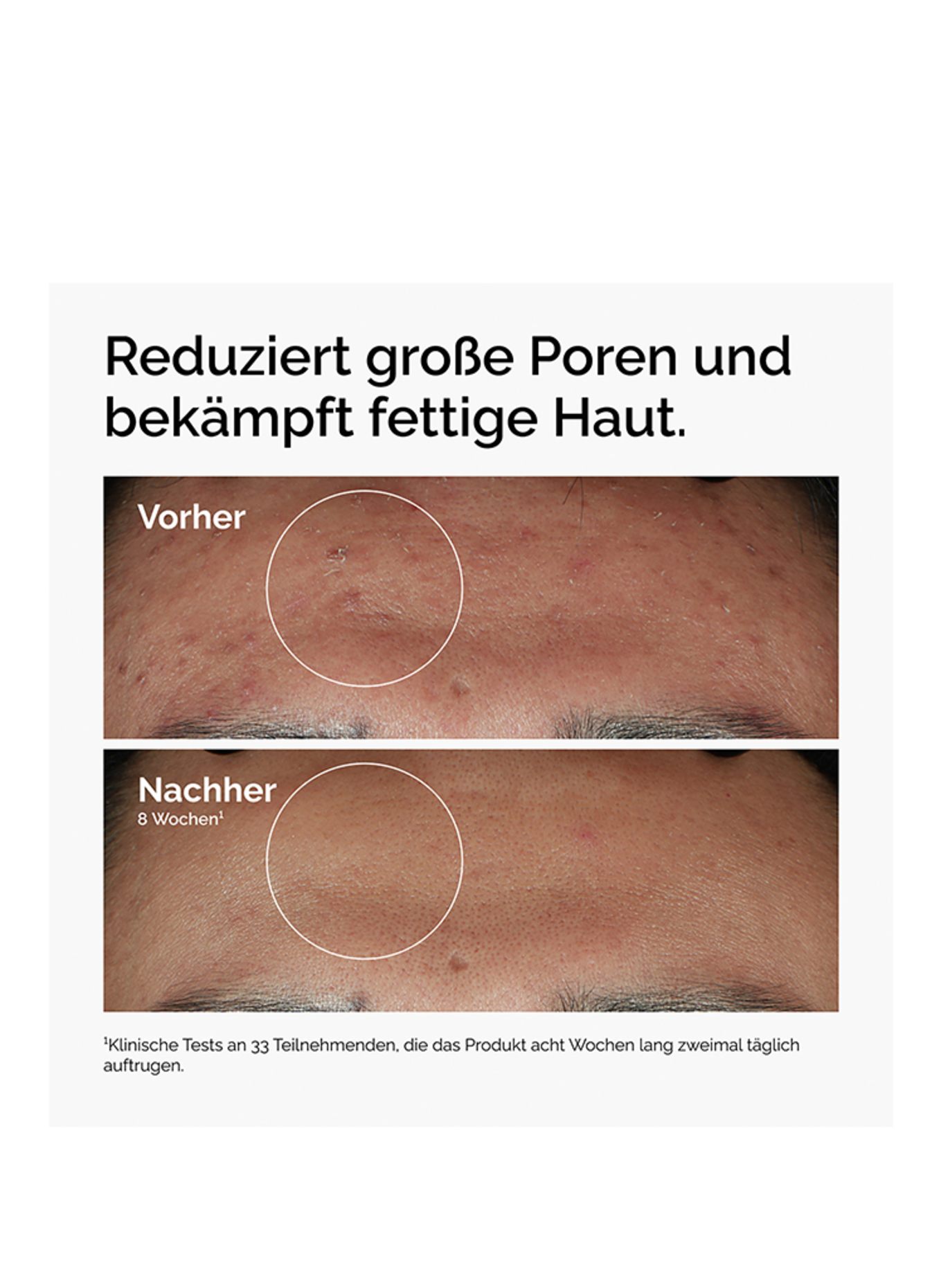 The Ordinary. NIACINAMIDE 10% + ZINC 1%