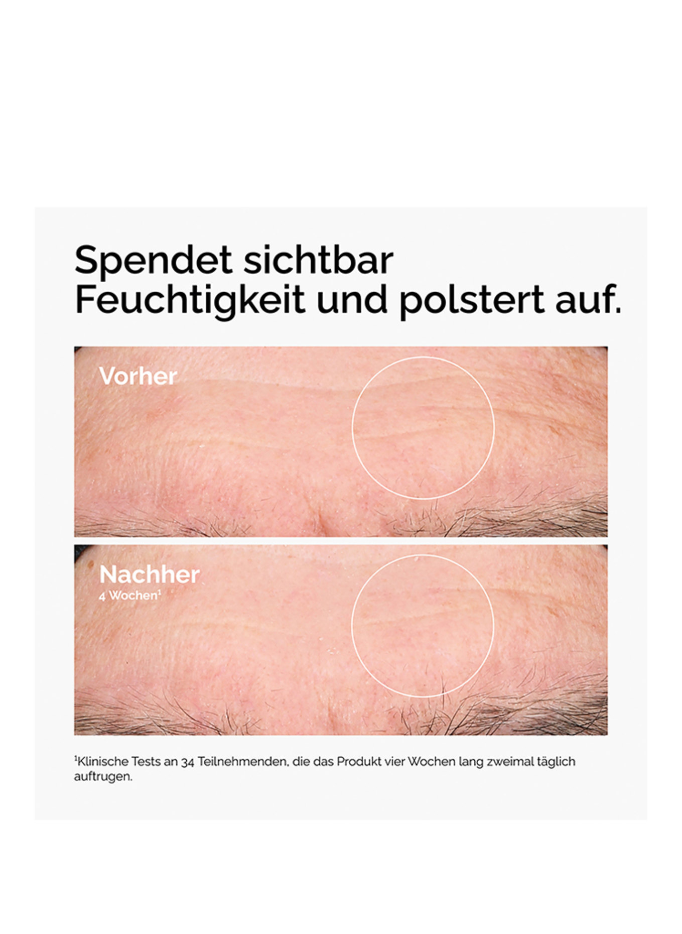 The Ordinary. HYALURONIC ACID 2% + B5 (Bild 3)