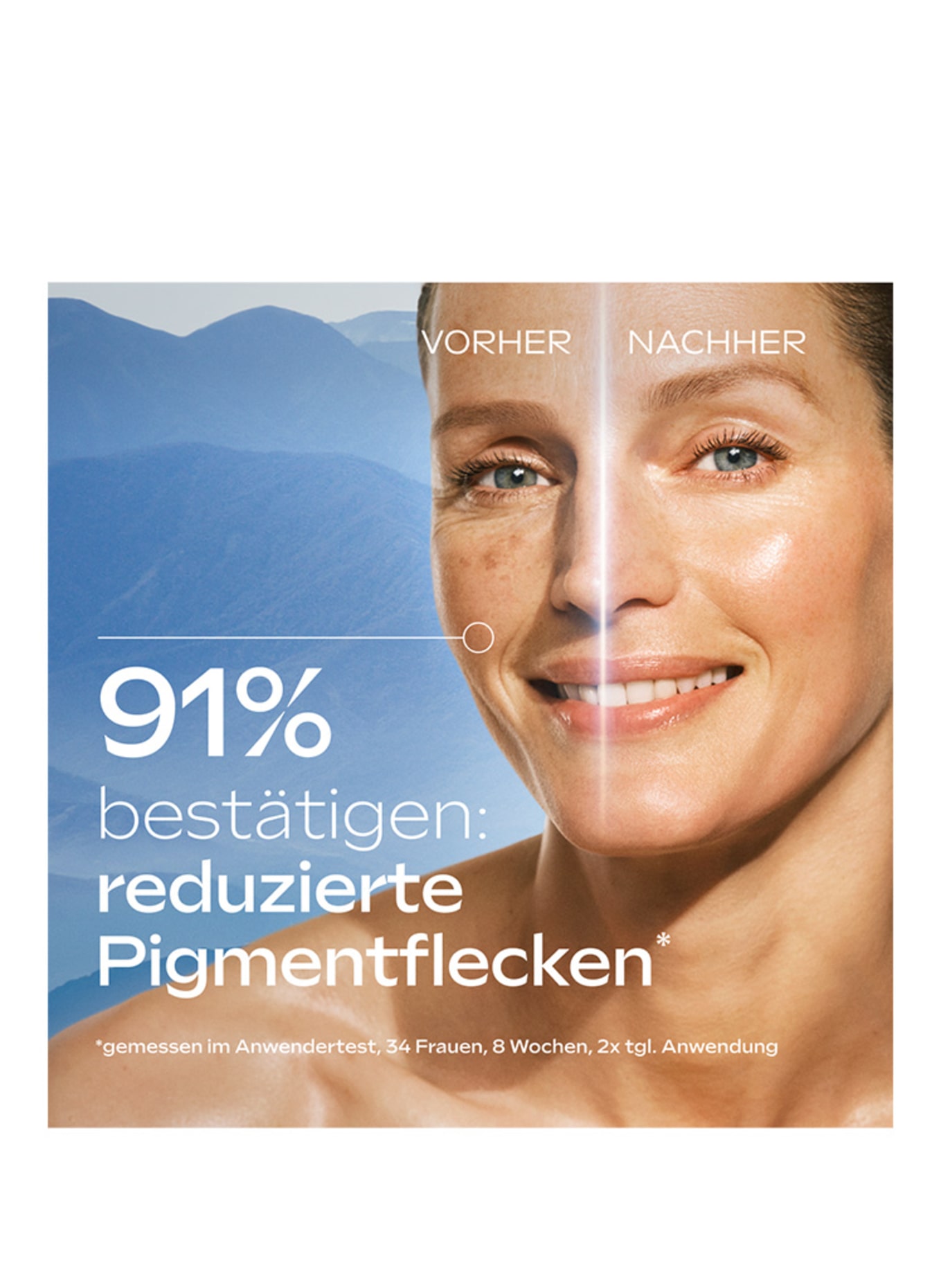 WELEDA ANTI-PIGMENTVLEKKEN BRIGHT SERUM