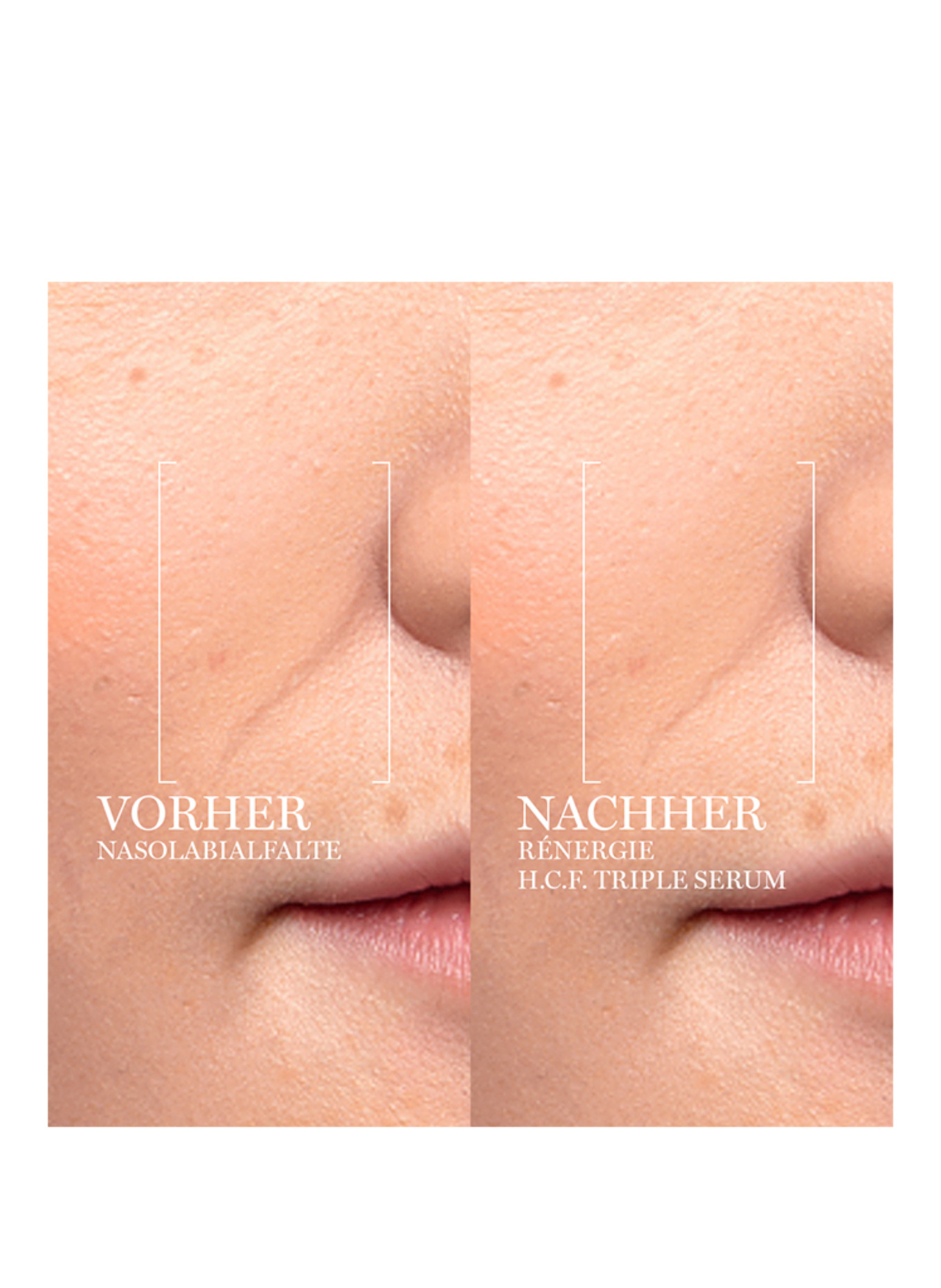 LANCÔME RÉNERGIE H.C.F. TRIPLE SERUM