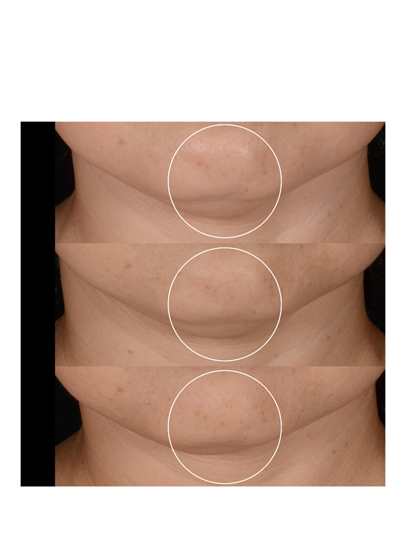 LANCÔME RÉNERGIE H.P.N 300 PEPTIDE CREAM