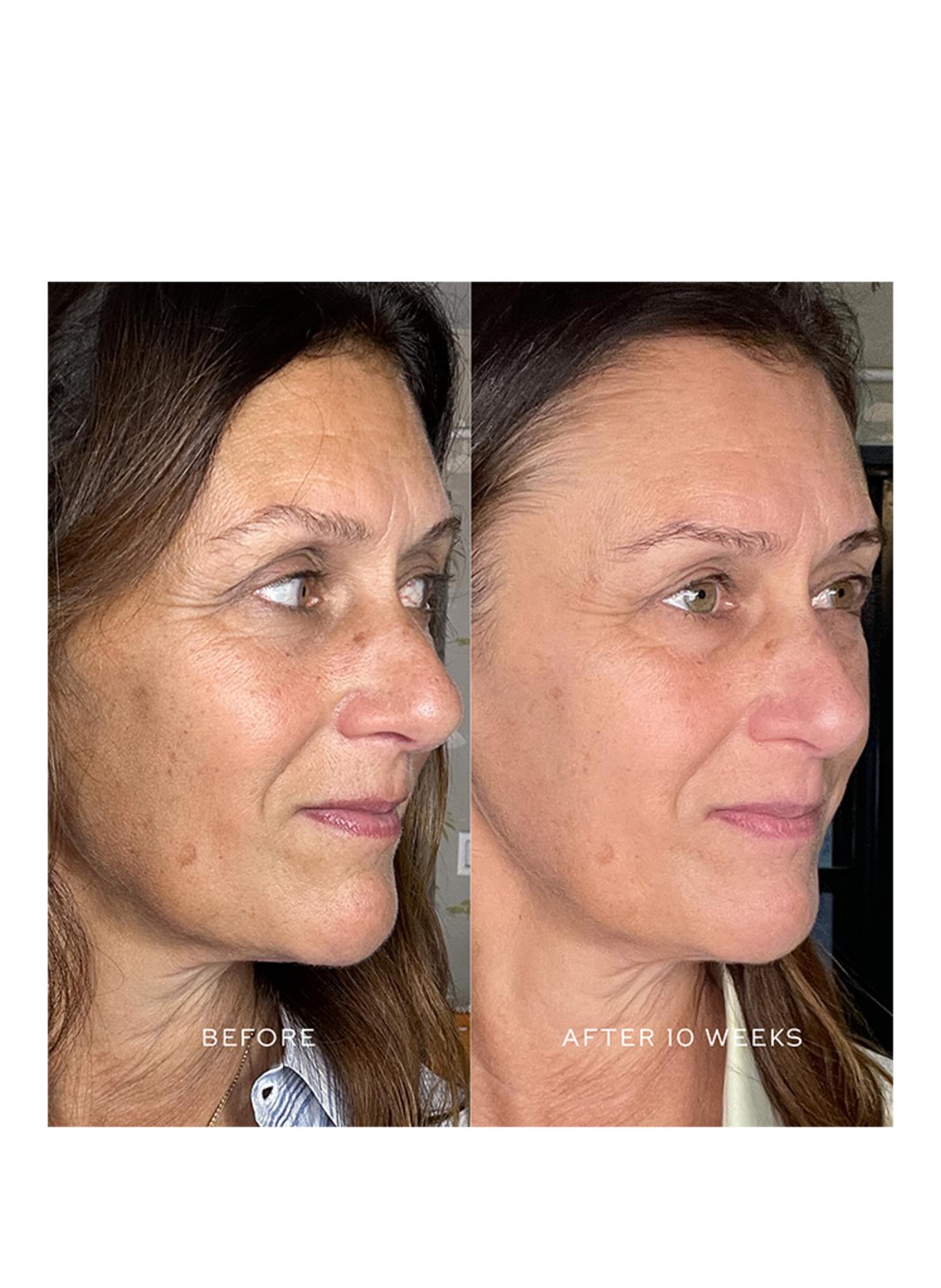 WESTMAN ATELIER SUPREME C VITAMINE C CONCENTRAAT