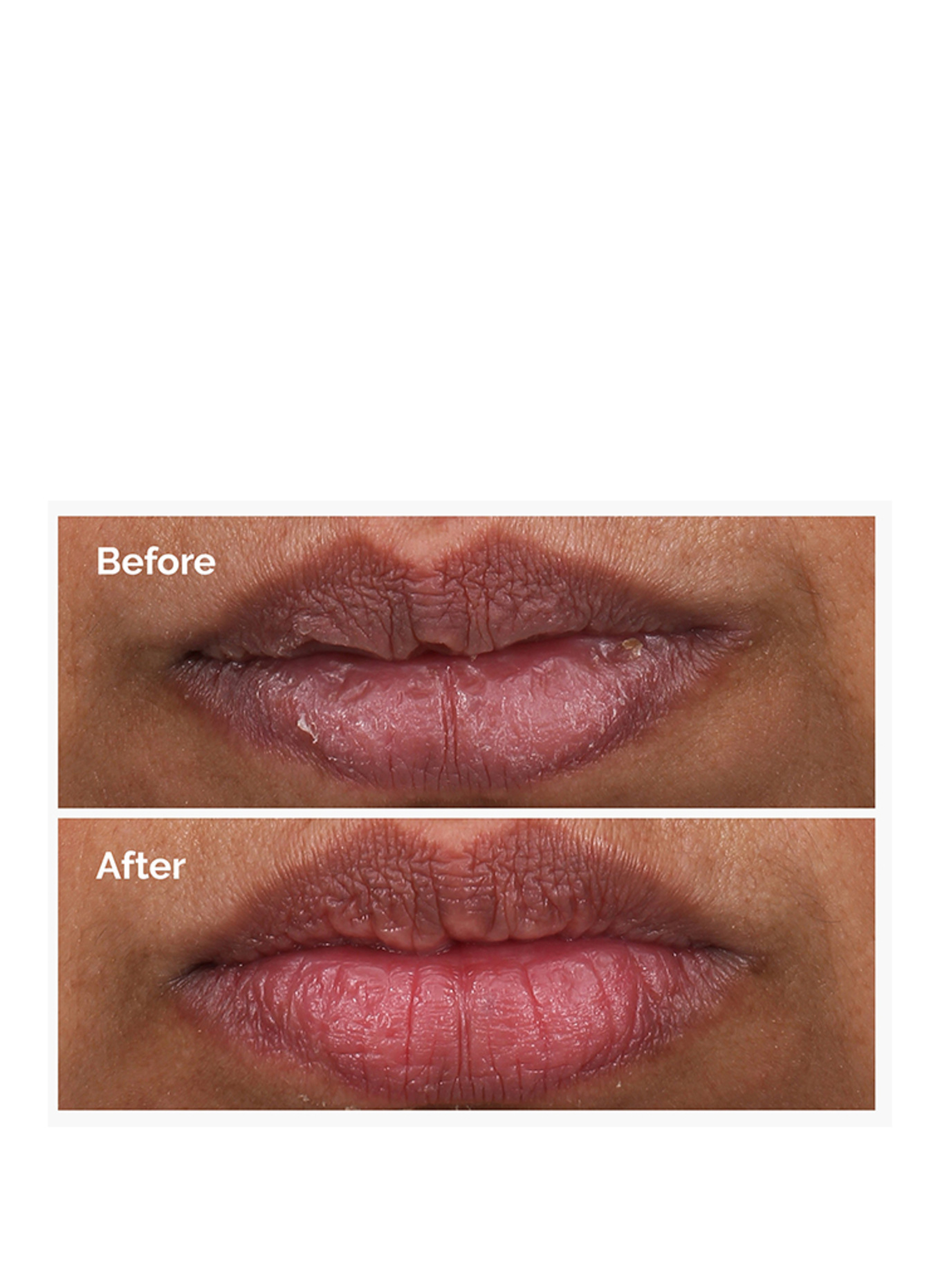 The Ordinary. PHA 5% EXFOLIËREND LIP SERUM