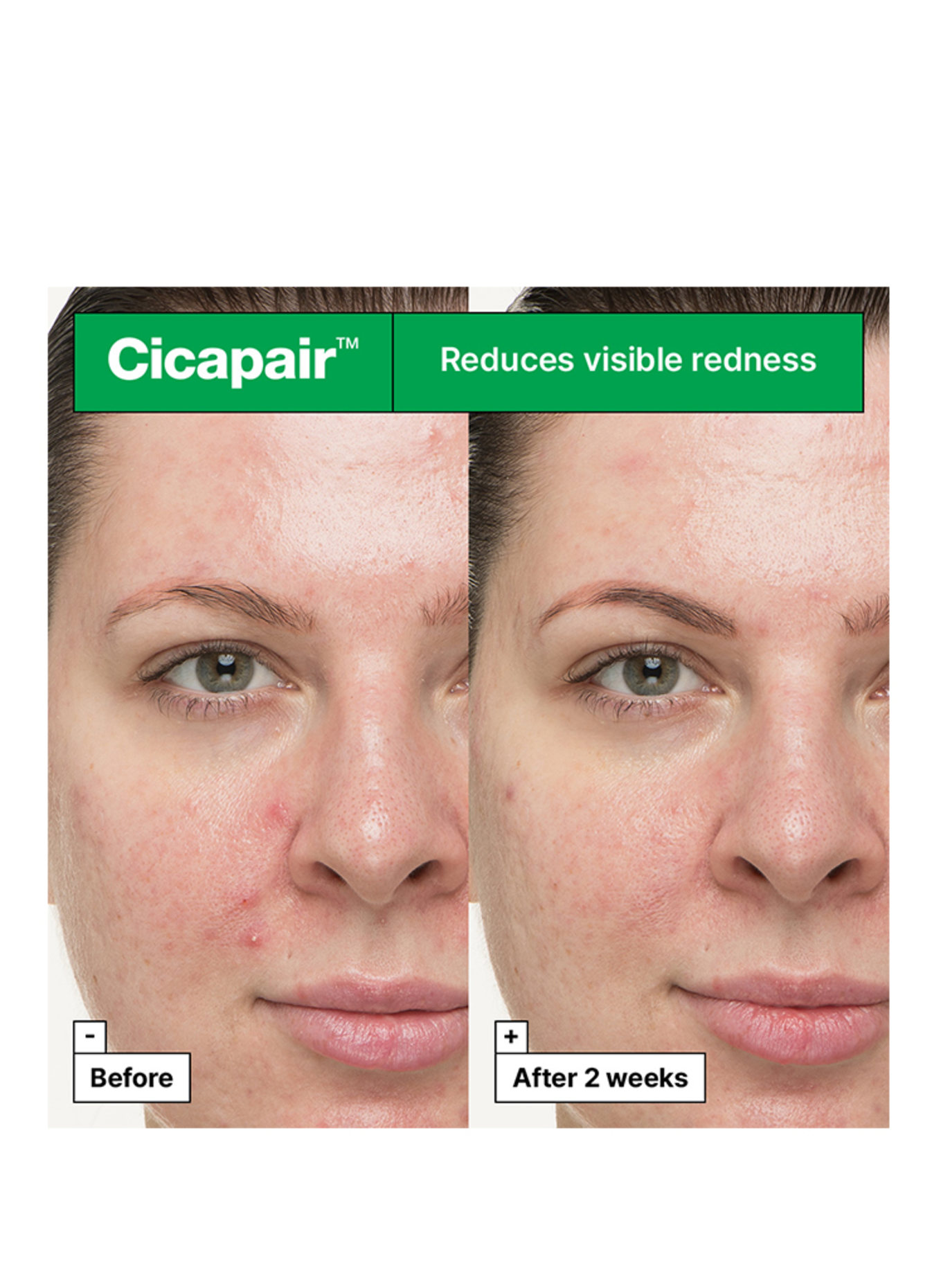 Dr.Jart+ CICAPAIR SO SOOTHING TREATMENT