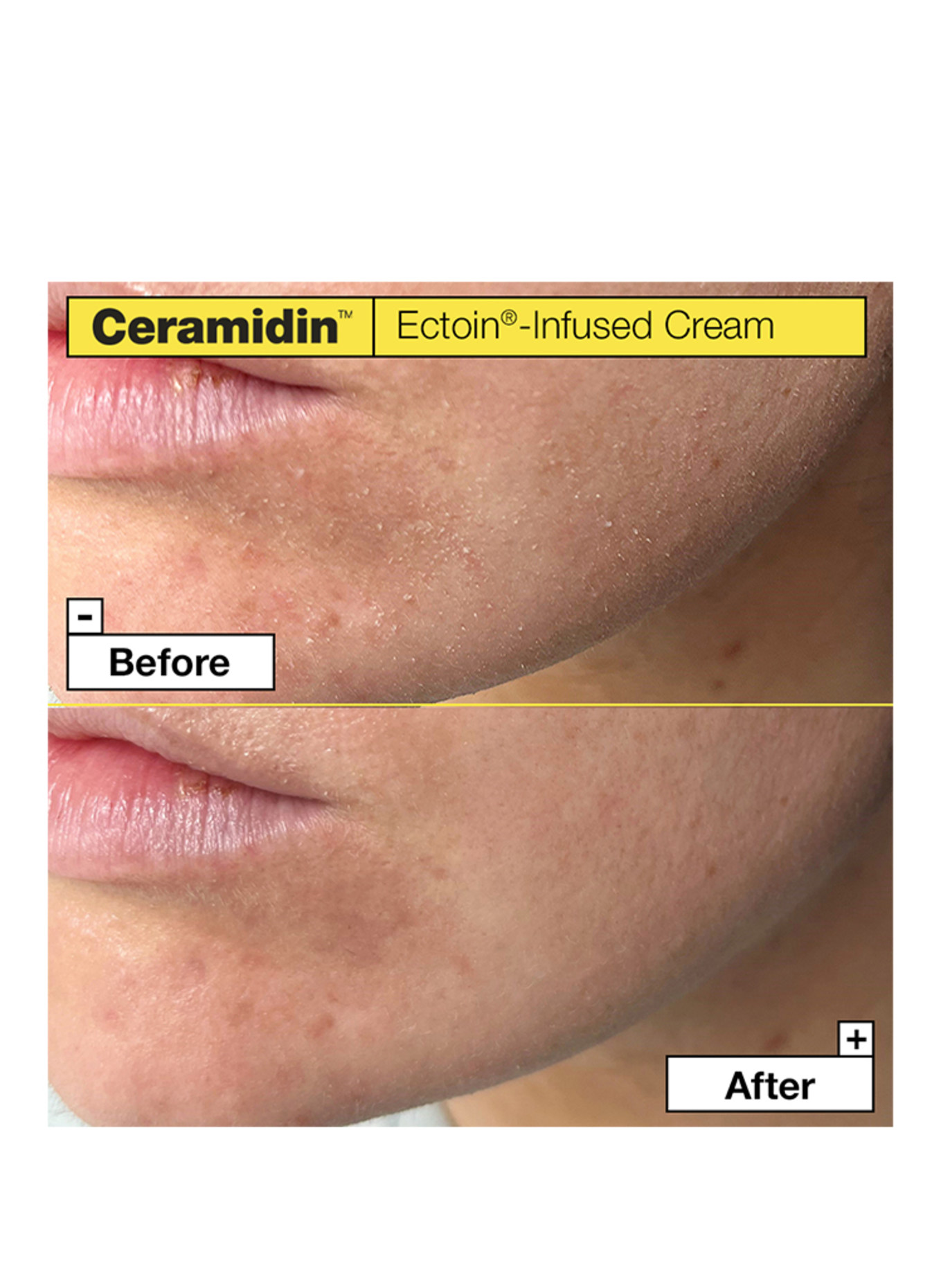 Dr.Jart+ CERAMIDIN ECTOIN-INFUSED CREAM