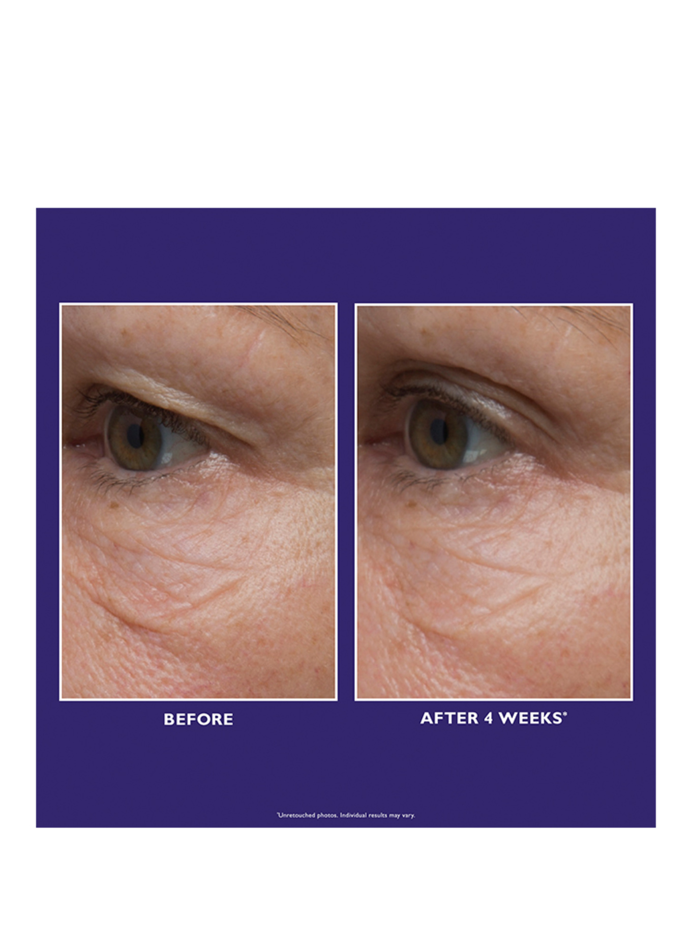 PETER THOMAS ROTH ULTIMATE SOLUTION 5