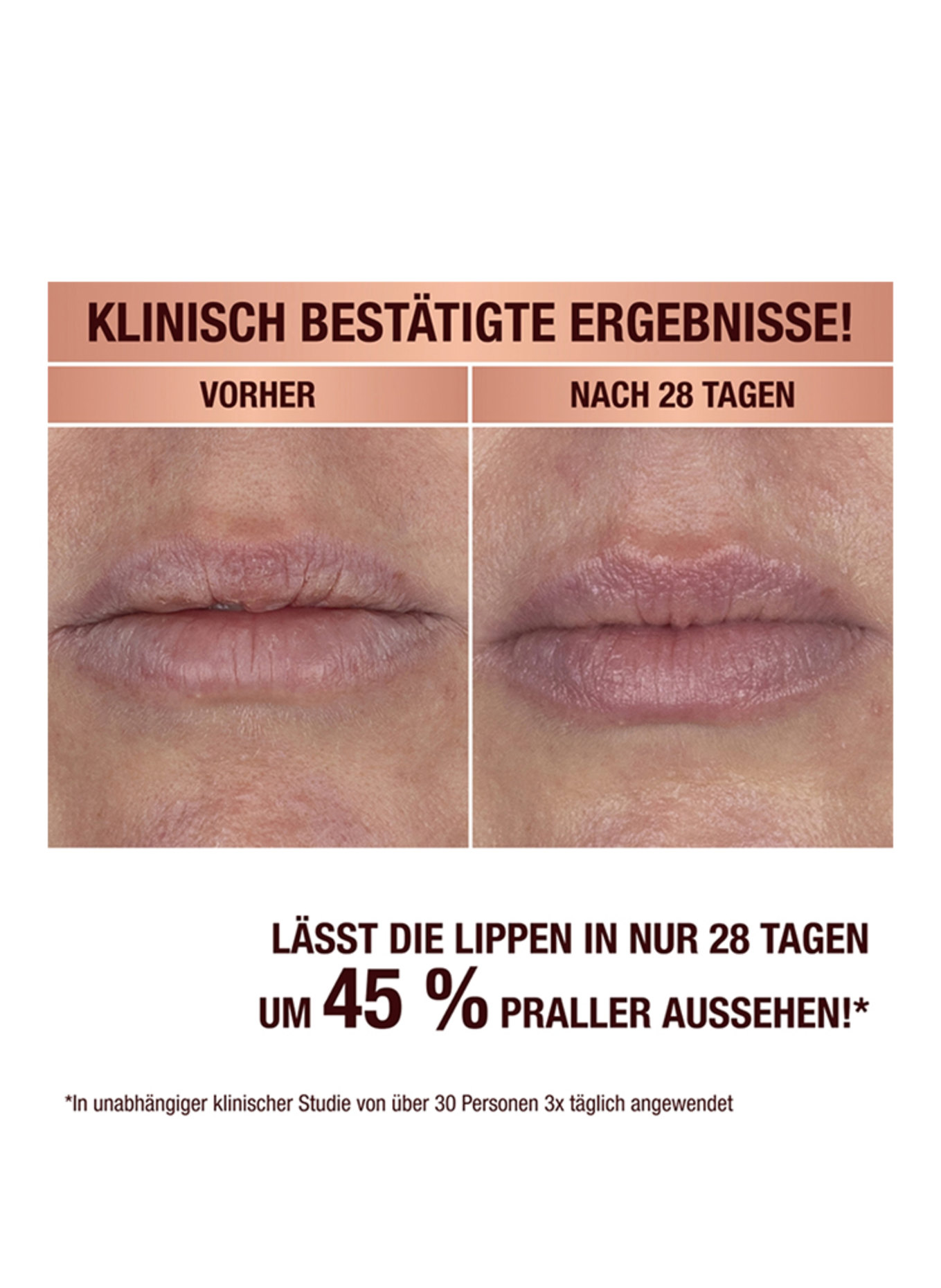 Charlotte Tilbury LEVENSVERANDEREND LIPMASKER
