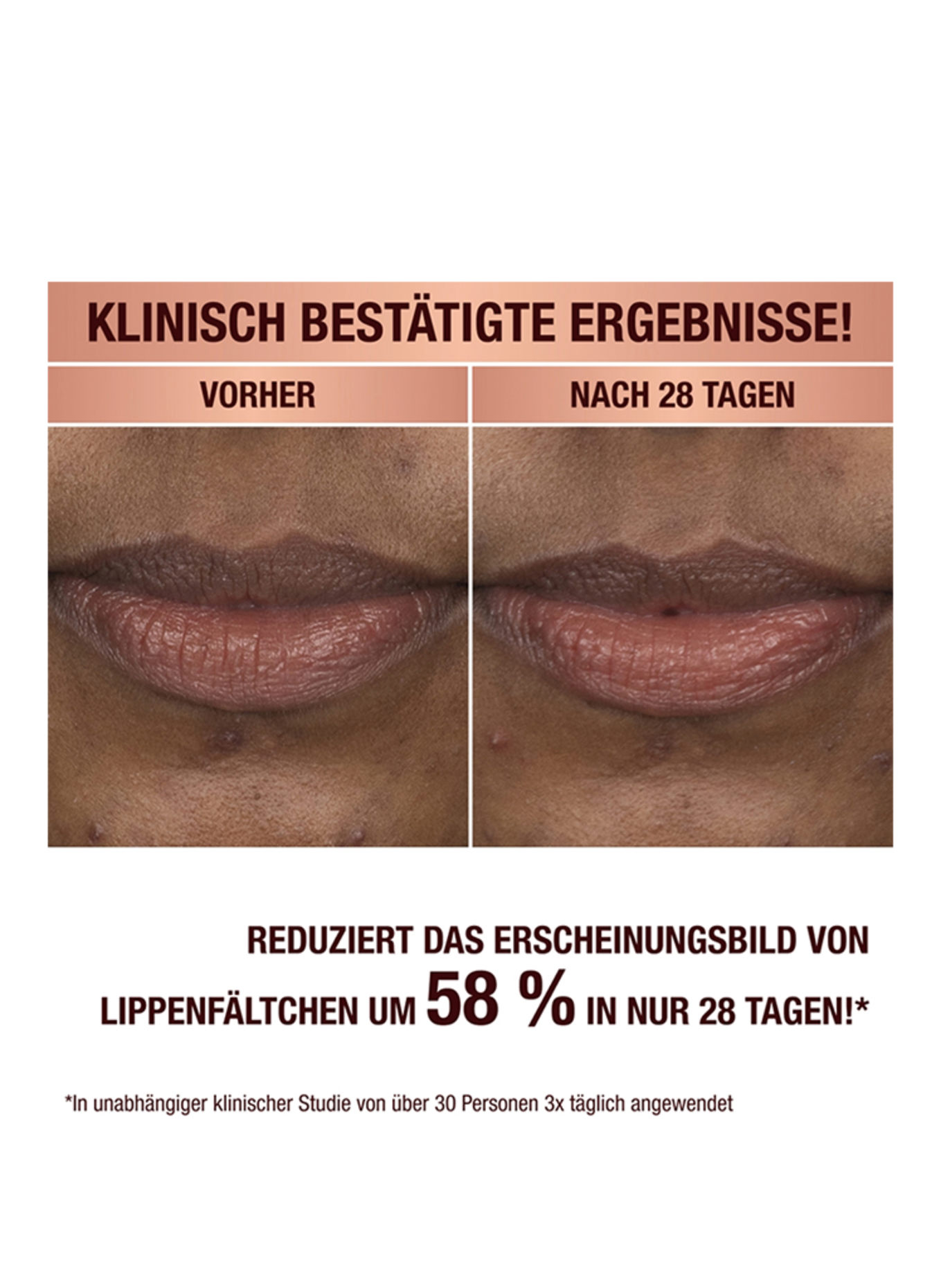 Charlotte Tilbury LEVENSVERANDEREND LIPMASKER