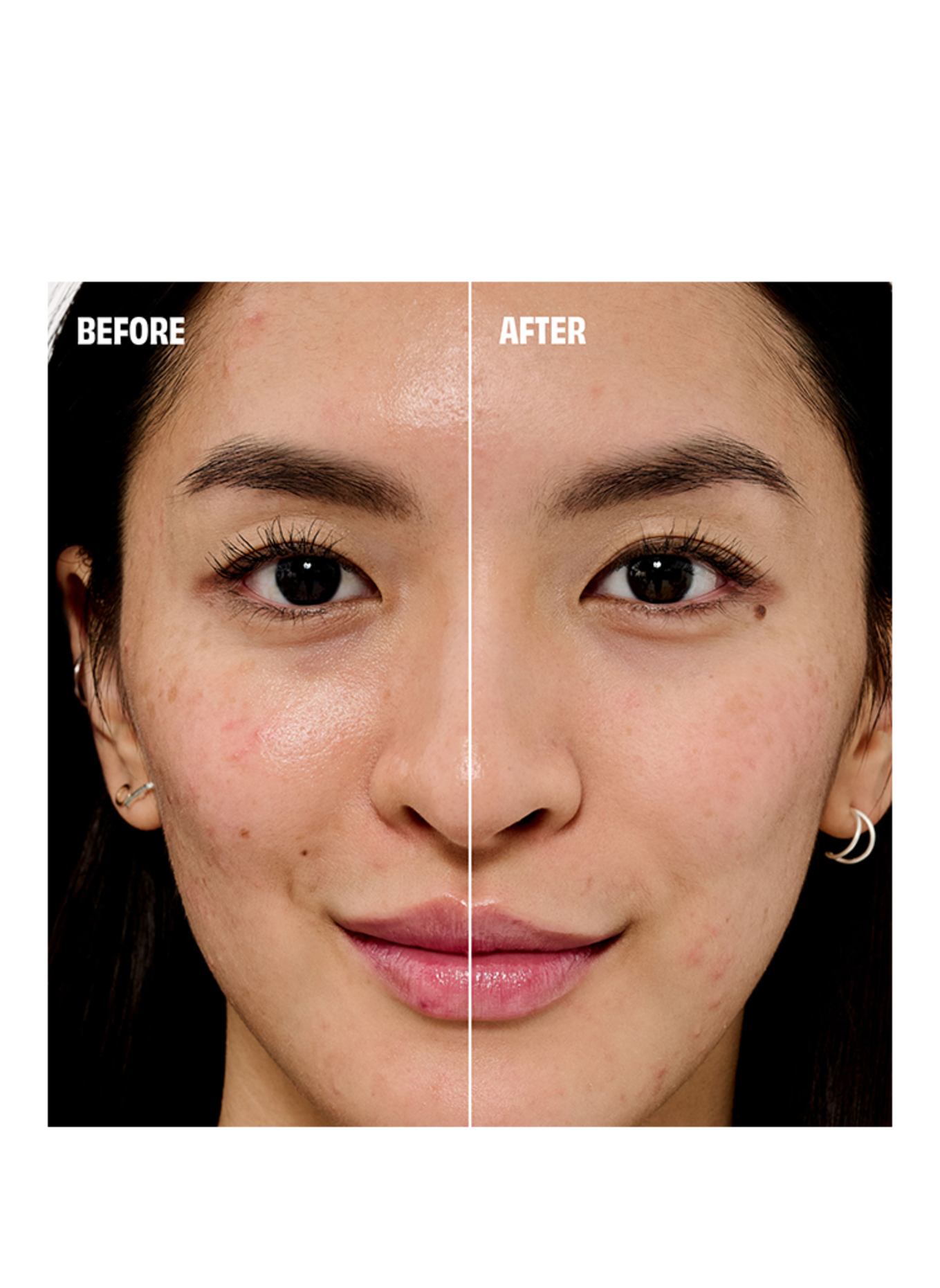 benefit THE POREfessional