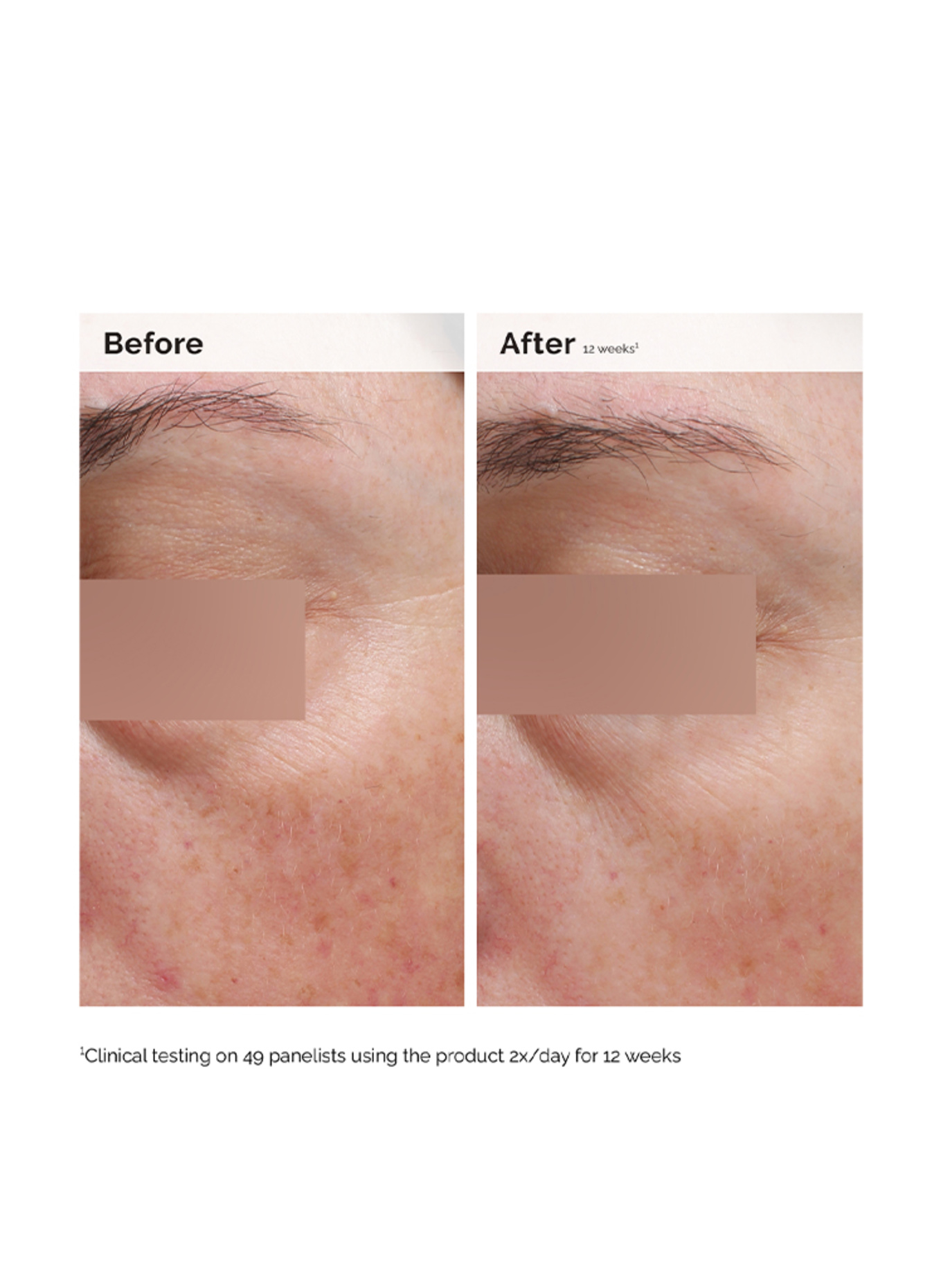 The Ordinary. NIACINAMIDE 5% FACE & BODY EMULSION