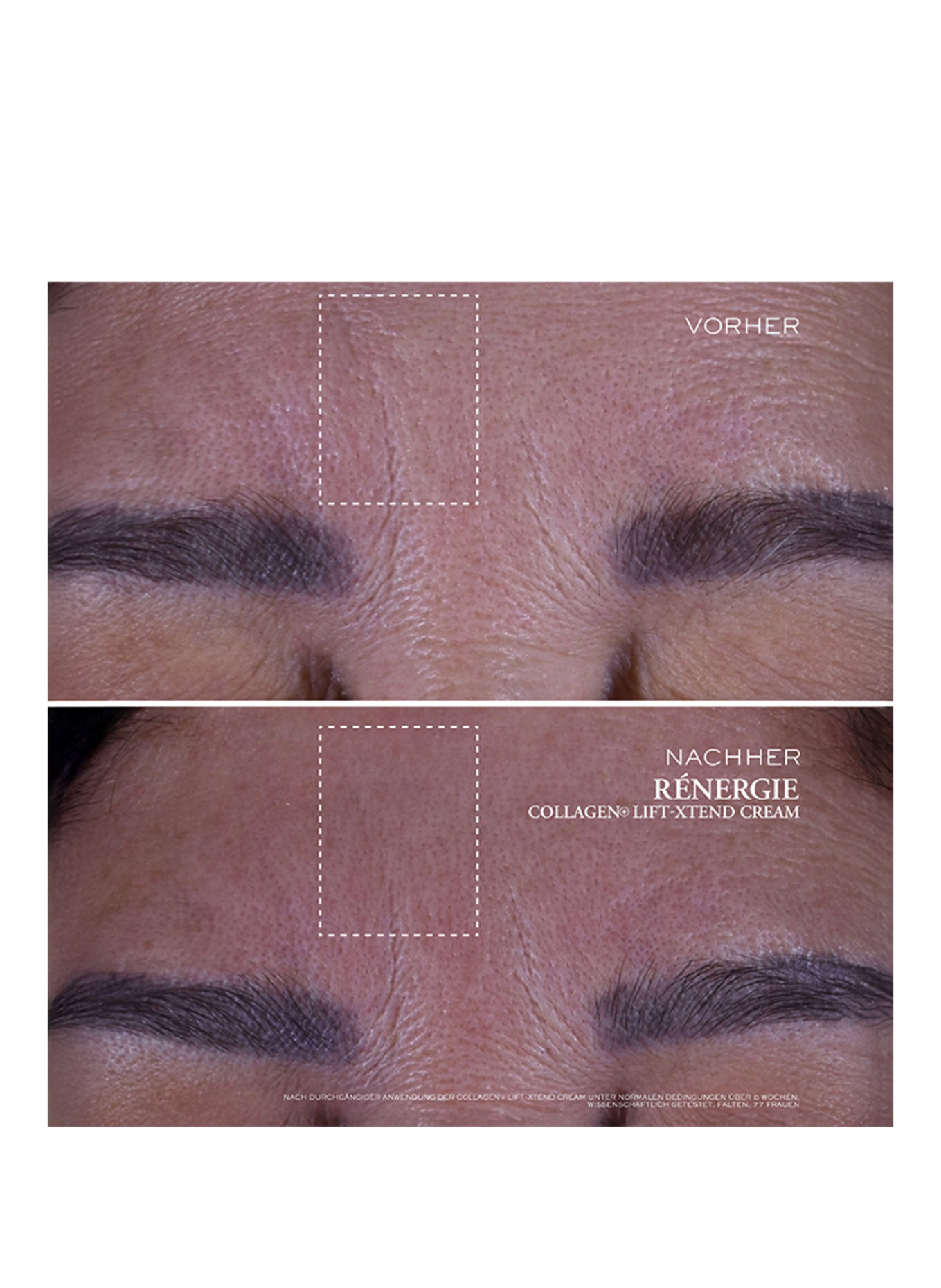 LANCÔME RÉNERGIE COLLAGEN LIFT-XTEND CREAM