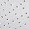 GRAU METALLIC