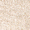 ROSÉ/ GOLD