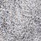 GRAU/ SILBER