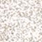 PLATIN METALLIC
