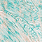 MINT/ BEIGE