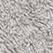 ALUMINIUM