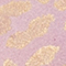 ROSA/ GOLD