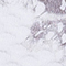 WEISS/ GRAU