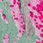 GRÜN/ ROSA
