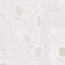 WEISS