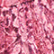 FUCSIA MEDIO