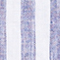 WEISS/ BLAU