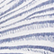 BLAU/ WEISS