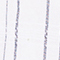 WEISS/ SCHWARZ