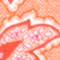 ROT