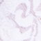 WEISS