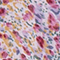 FUCHSIA/ ROSA/ BLAU