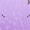 PURPLE / LIGHT PURPLE