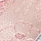 ALTROSA/ SILBER/ ROSÉ