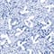 BLAU/ WEISS