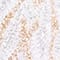 WEISS/ GOLD/ SILBER